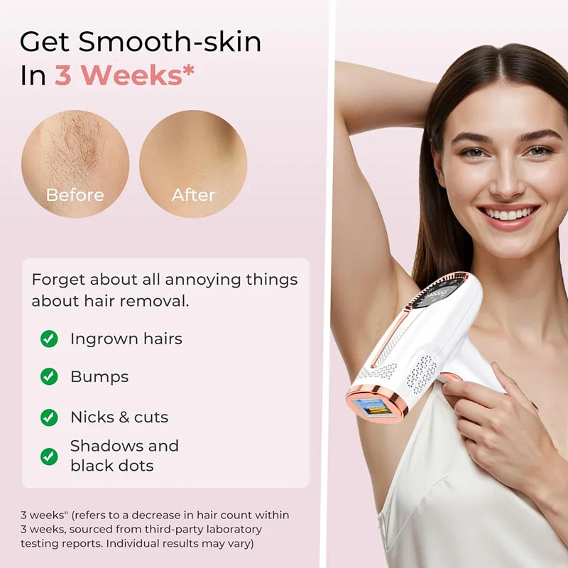 IPL Hair Removal Device – Painless At-Home Laser Hair Removal for Smooth Skin